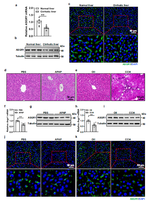 Hepatic ASGR1 is downregulated in cirrhotic patients and liver injured mice.